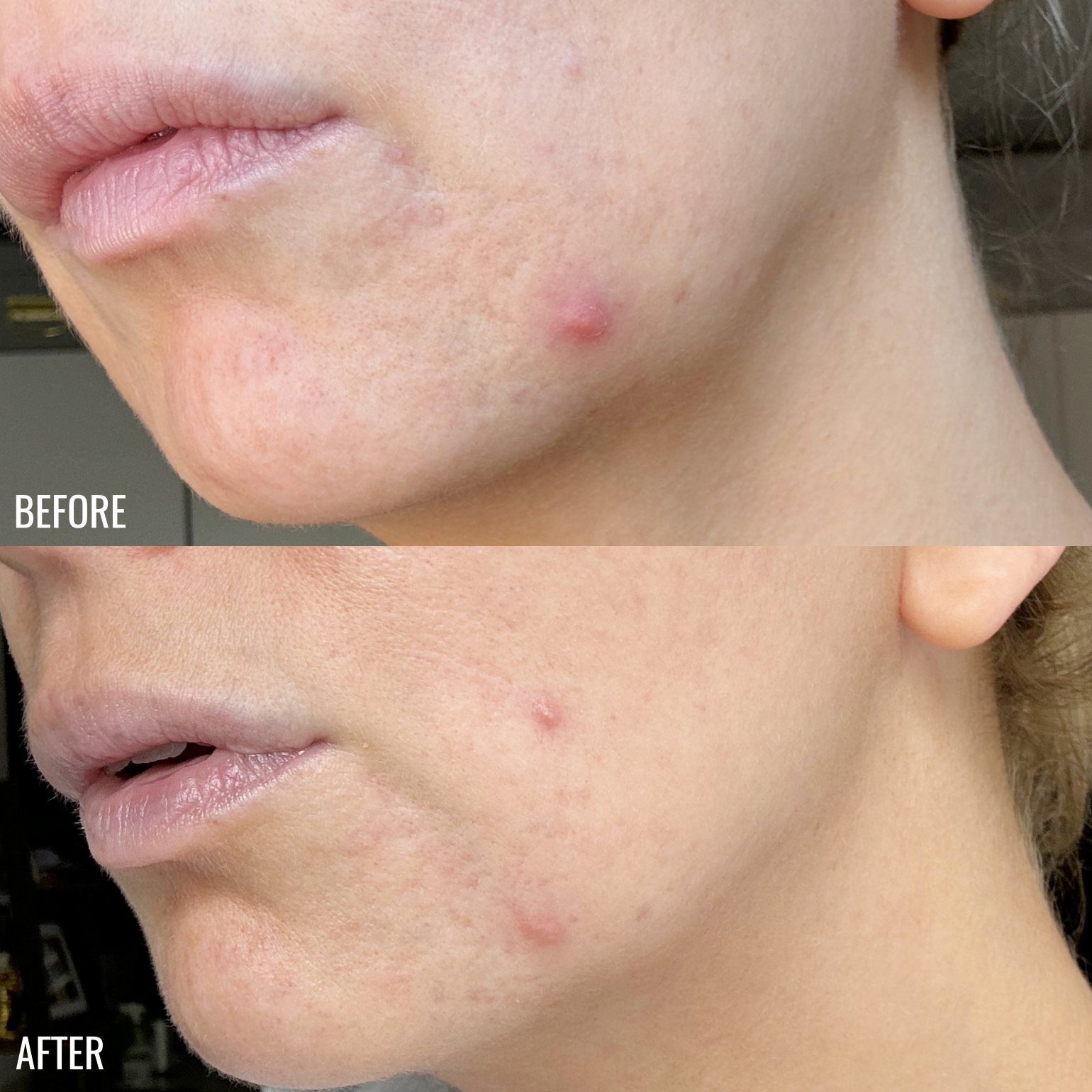 ZIIP-DOT-Before-After