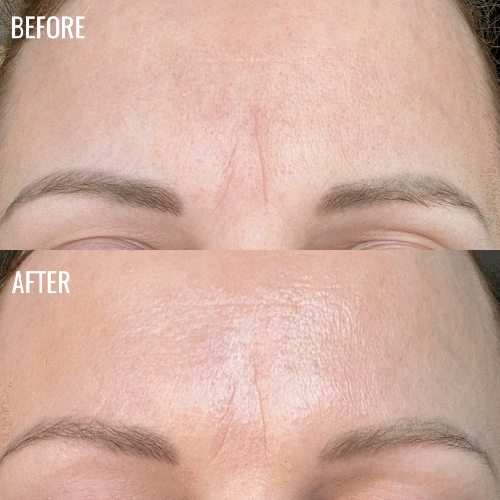 Elevenses-before-and-after-pic-RF