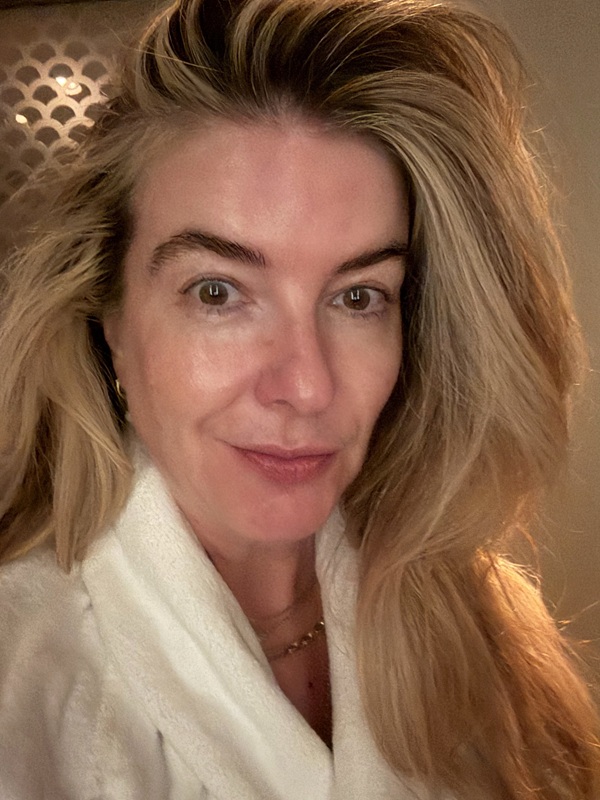 AMAN Advanced Facial - After Photo