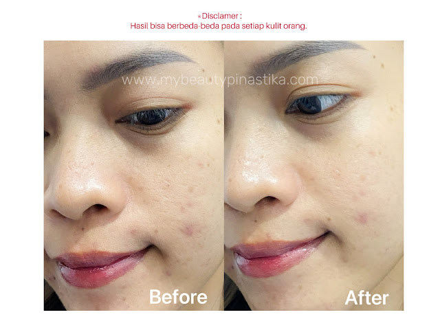Hasil Scarlett Aqua Reset & Barrier Gel Moisturizer