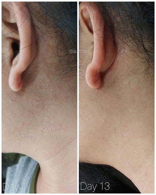 hasil skintific 5x ceramide moisture gel pada kulit kering hasil pemakaian skintific 5x ceramide barrier repair moisture gel