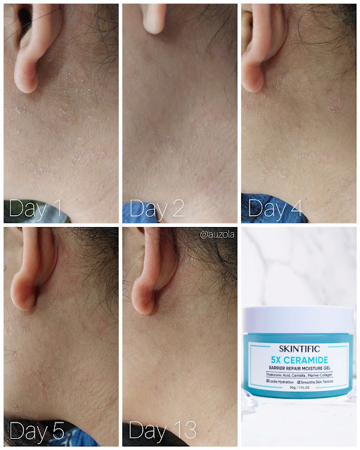 rekomendasi moisturizer untuk kulit kering skintific 5x ceramide untuk kulit kering