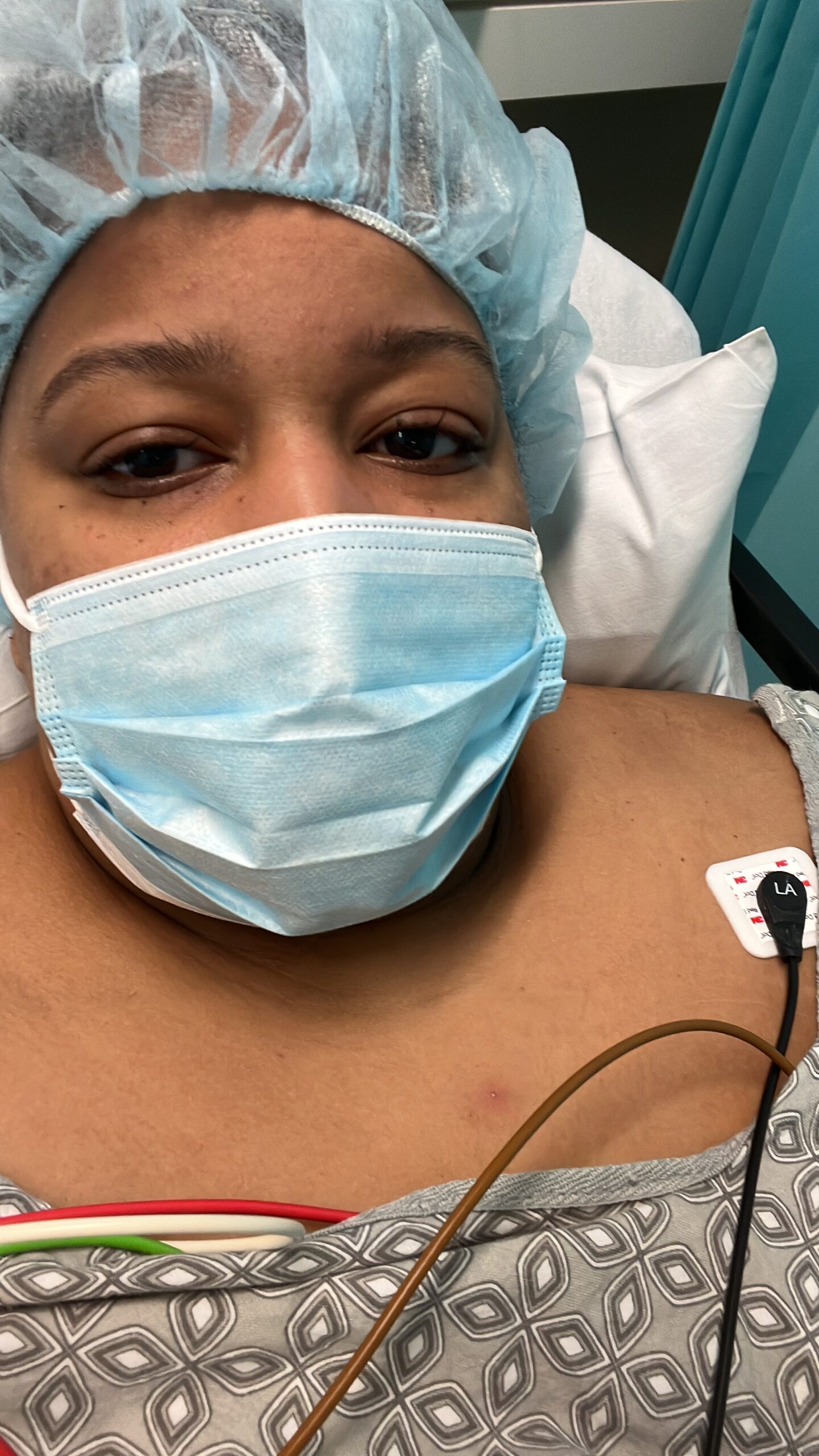 plus size fashion looks from Chardline chanel. Chardline is getting weight loss surgery. She is laying in a bed prepared to get weight loss surgery.