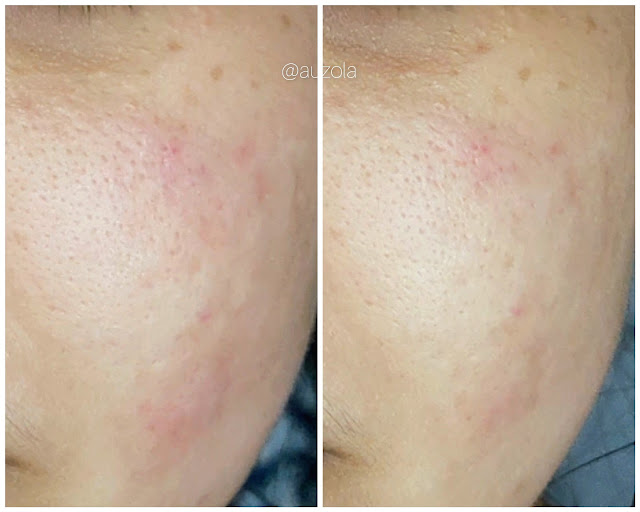 mengurangi kemerahan kulit dengan skintific clay mask