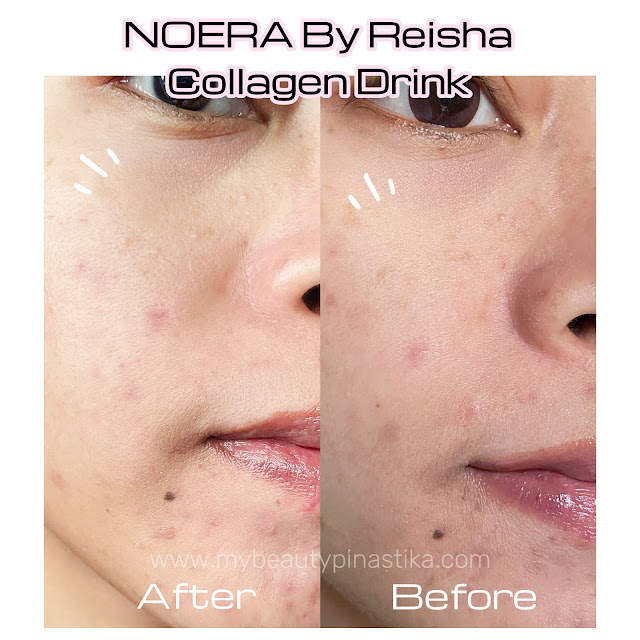 Testimoni Noera Collagen Drink