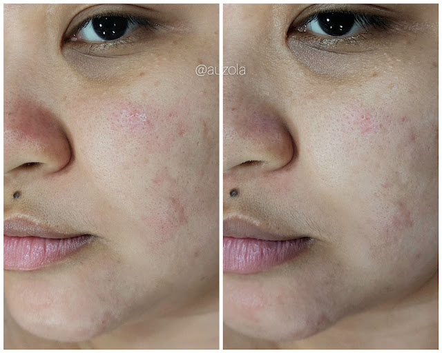 hasil penggunaan skintific mugwort clay mask