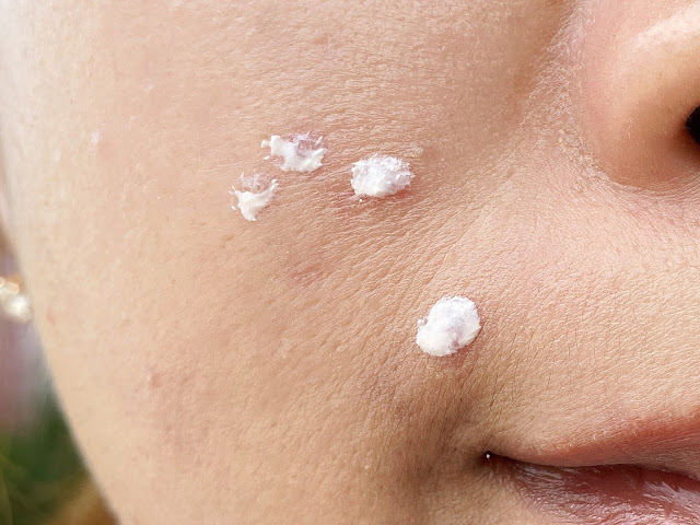 Review NOERA Acne Drying Lotion