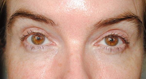 Ole Henriksen Banana Bright Vitamin CC Stick Review & Swatches 6 Ole Henriksen Banana Bright Vitamin CC Stick Before Photo